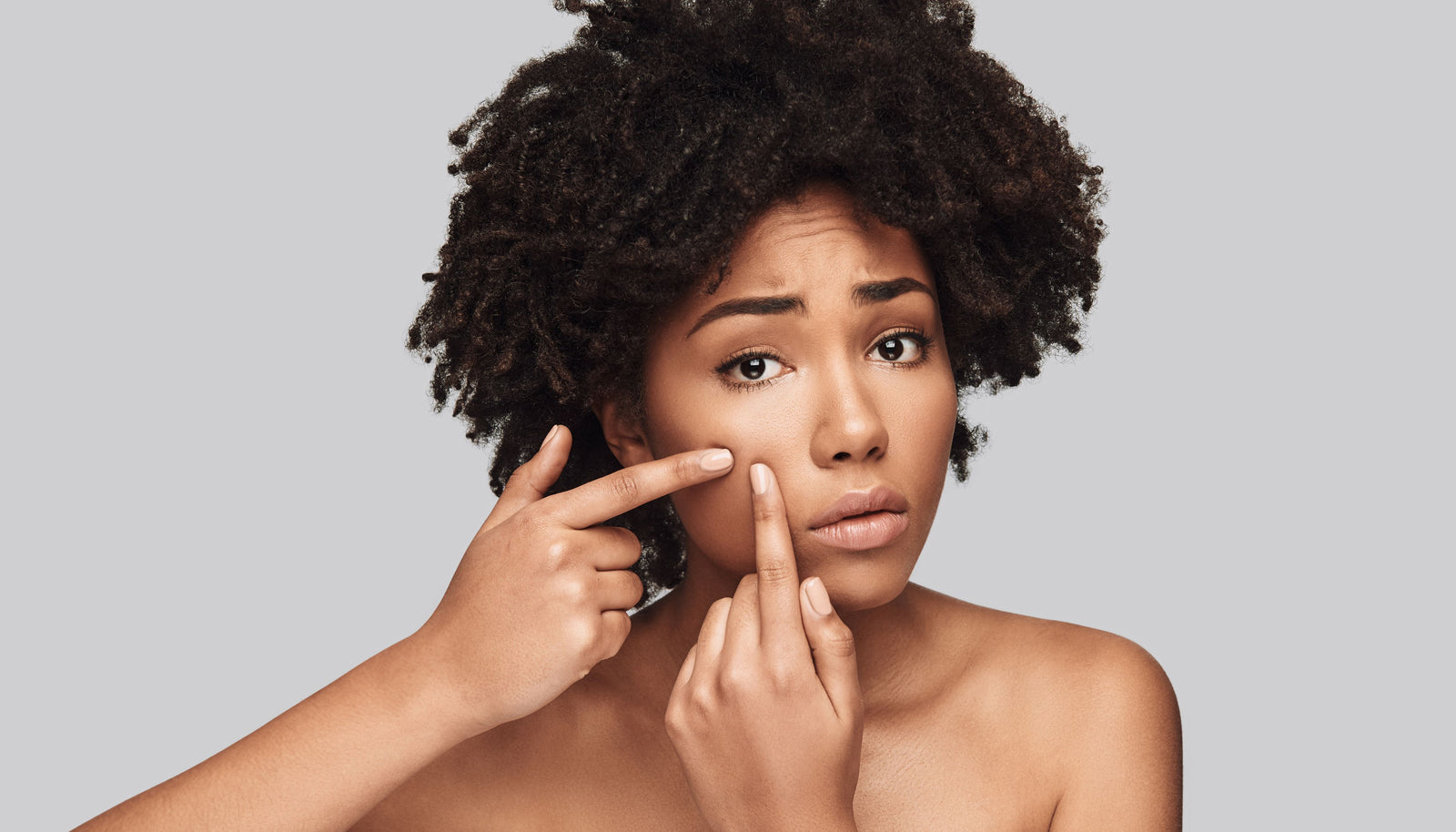 The Power of Clay and Charcoal for Treating Acne