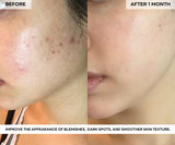 BEAUTY POPS™ Glow Enzyme Frozen Mask (MASK ONLY)