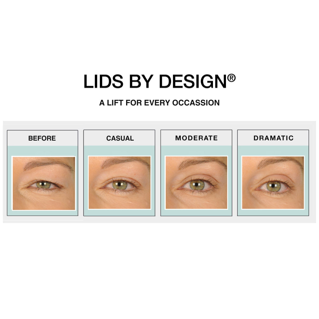 Lids By Design Cosmetic Eyelid Strips