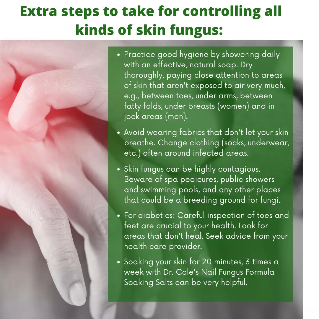 07 - Dr. Cole's Antifungal Balm