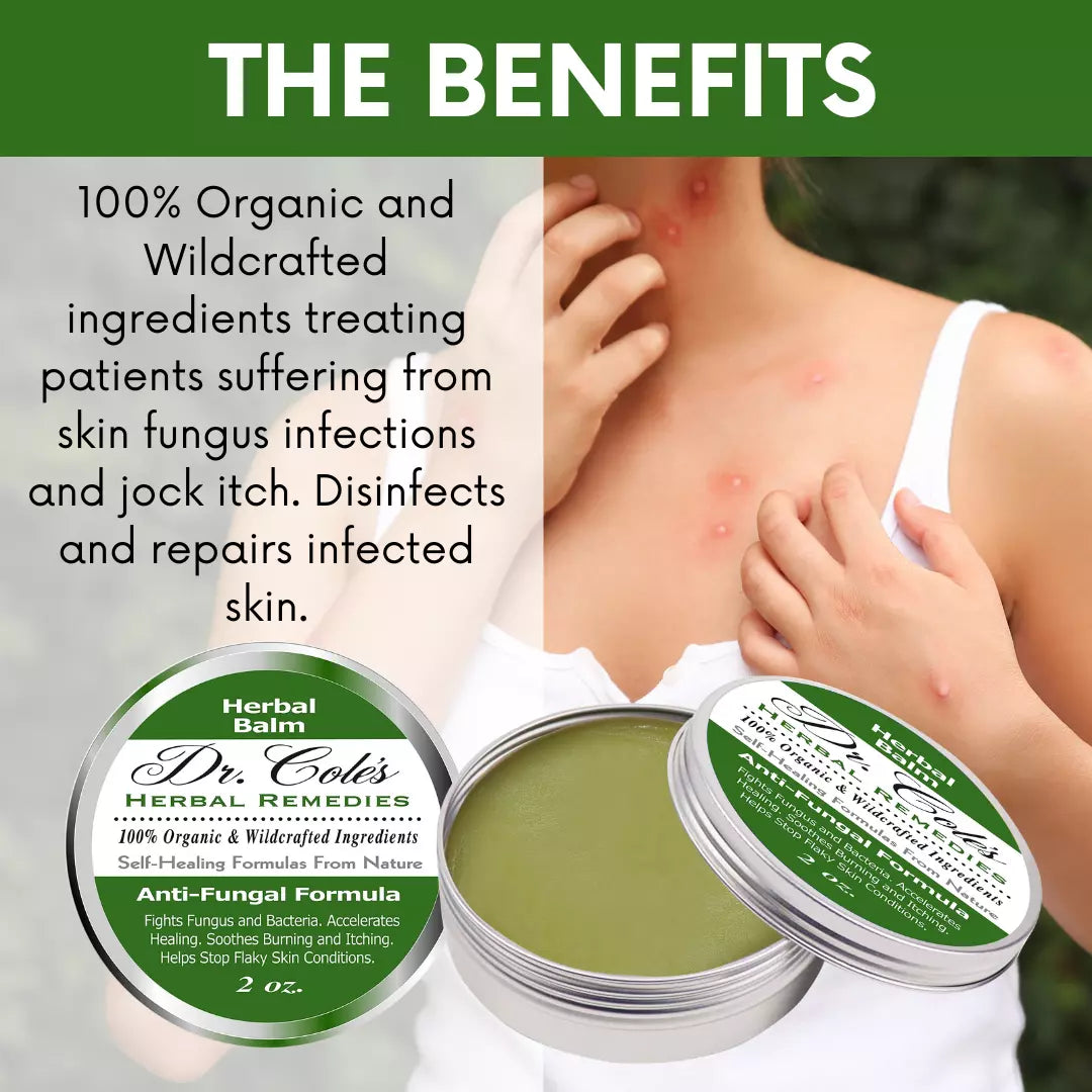07 - Dr. Cole's Antifungal Balm