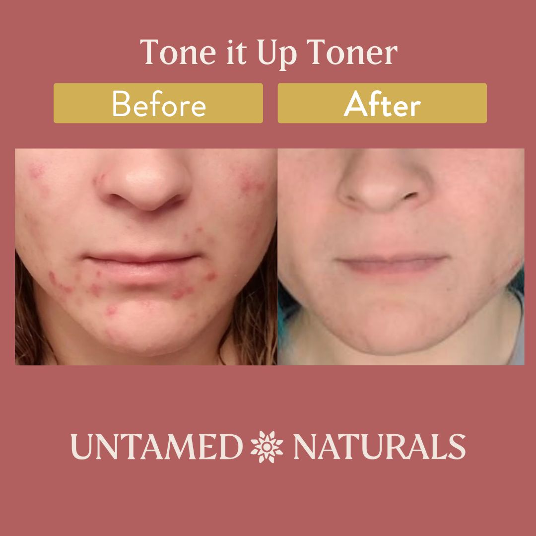 Tone It Up! Toner by UnTamed Naturals