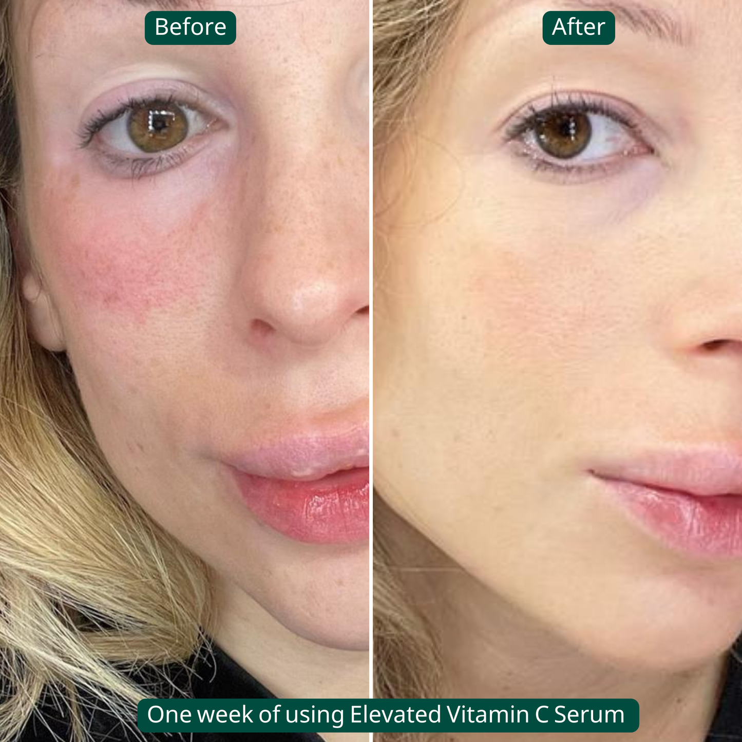 Elevated Vitamin C Serum - Tightens Skin & Brightens Skin