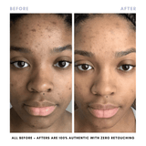 BUNDLE & SAVE! The Balancing Treatment Duo