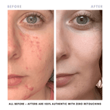 BUNDLE & SAVE! The Balancing Treatment Duo