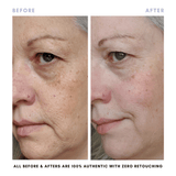 BUNDLE & SAVE! The Balancing Treatment Duo
