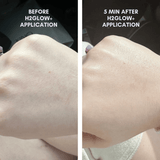 BUNDLE & SAVE! The Skin Reset Starter Kit