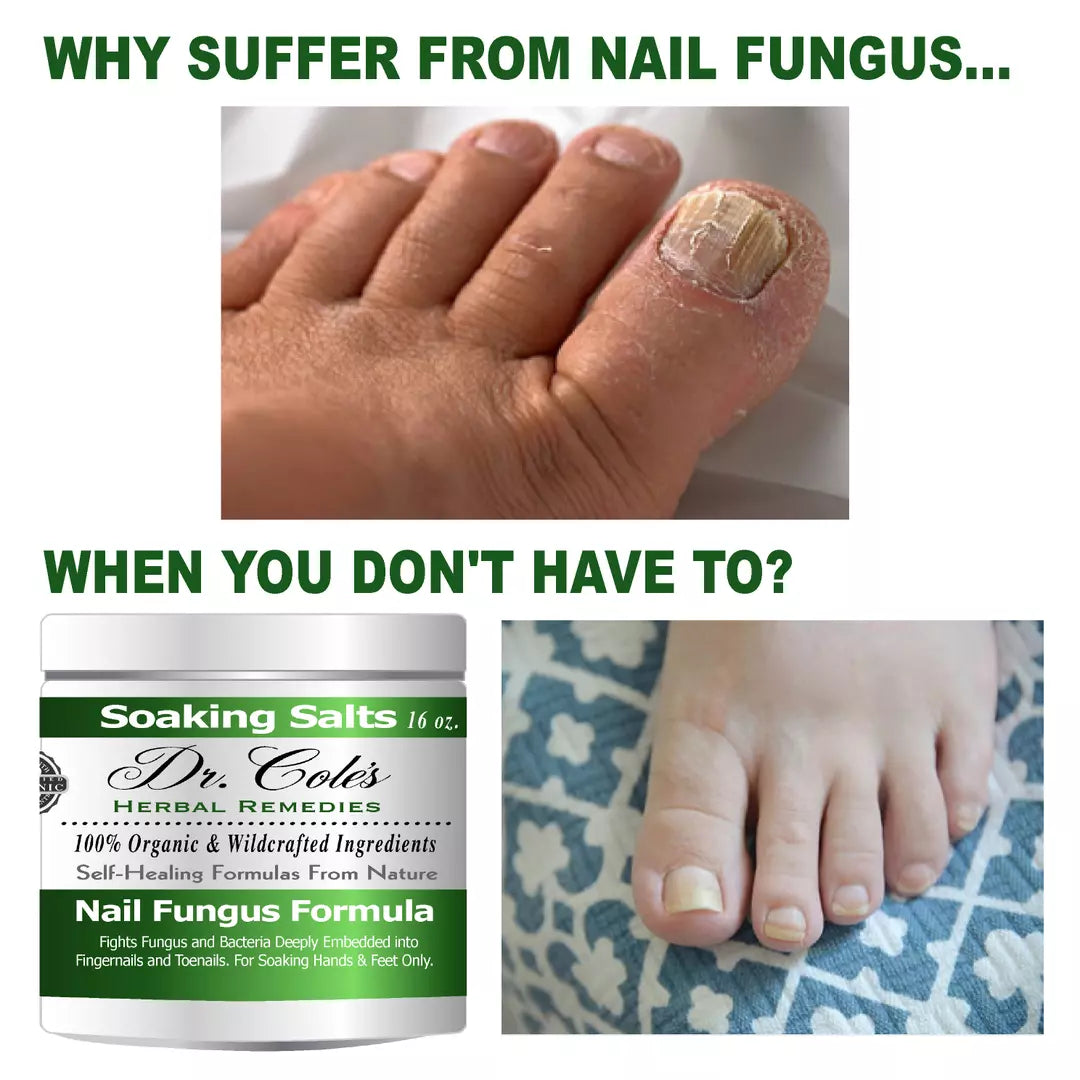 13 - Dr. Cole's Organic Nail Fungus Salts Formula