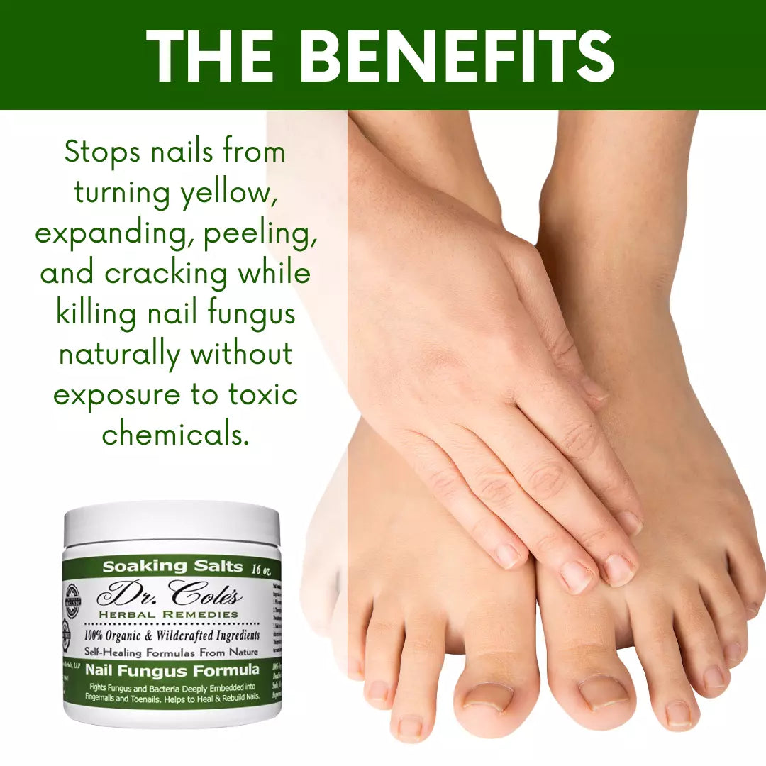 13 - Dr. Cole's Organic Nail Fungus Salts Formula