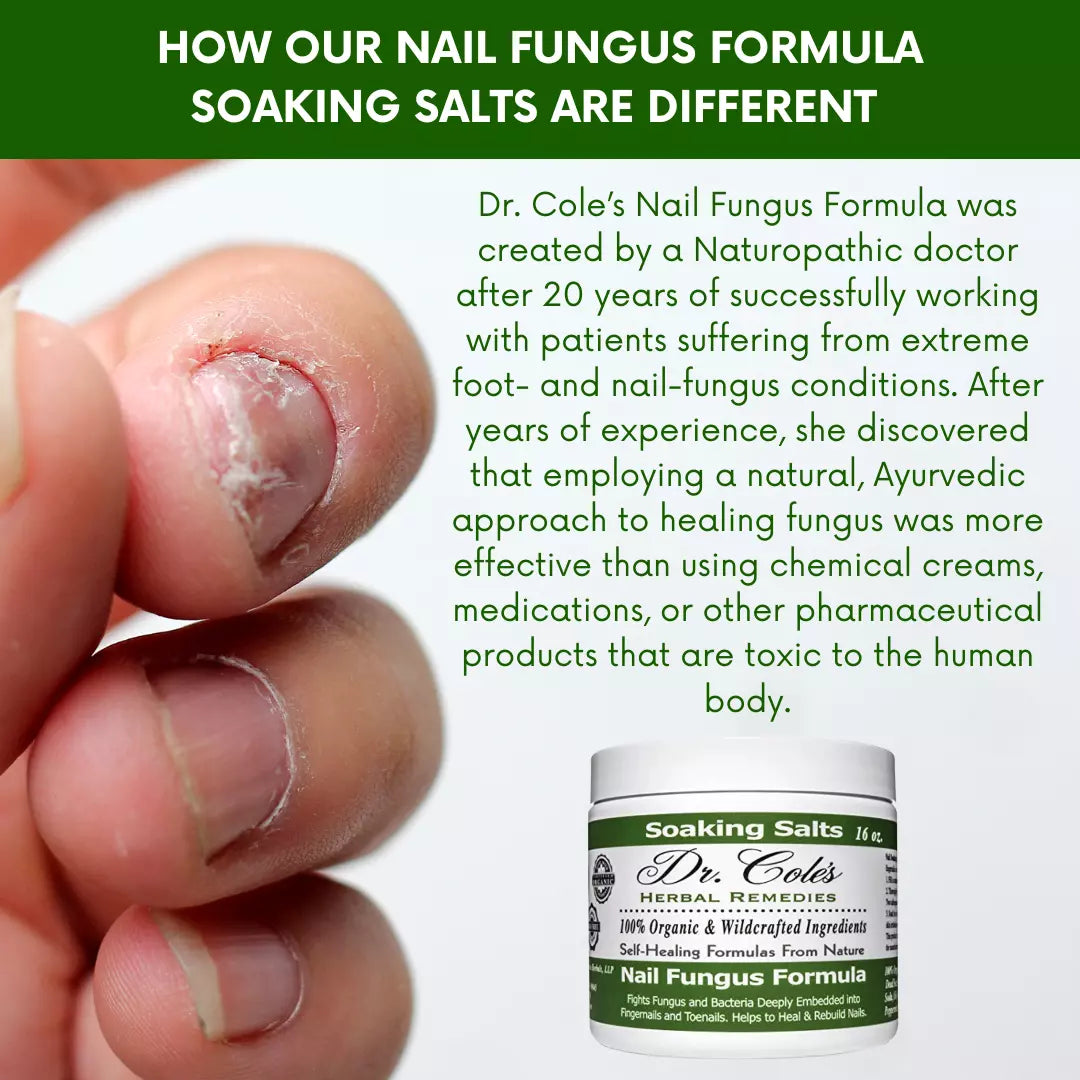 13 - Dr. Cole's Organic Nail Fungus Salts Formula