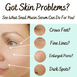 Rosie Claire Snail Mucin Serum with Vitamin C & E - Skin